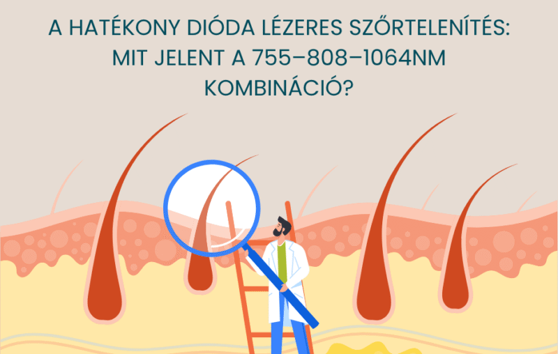 hatekomny dioda lezeres szortelenites