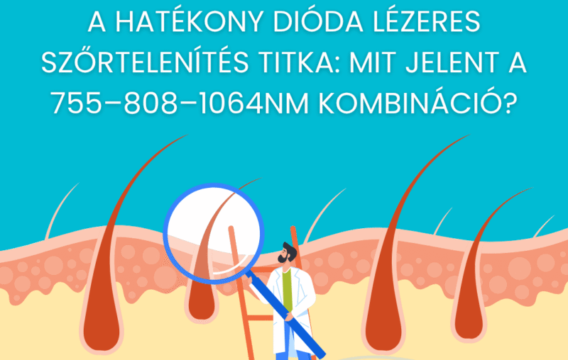 A hatékony dióda lézeres szőrtelenítés titka: mit jelent a 755–808–1064 nm kombináció? 55 hatekony dioda lezeres szortelenites 1