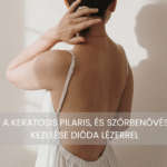 Keratosis pilaris kezelese dioda lezerrel van megoldas a csirkeborre es a szorbenovesre is 2