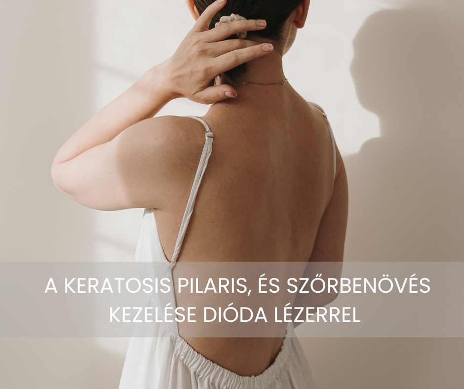 Keratosis pilaris kezelese dioda lezerrel van megoldas a csirkeborre es a szorbenovesre is 2
